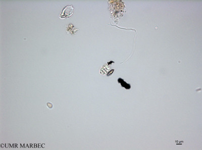 phyto/French_Polynesia/Tahiti_Ifremer/PHYTOCONT June 2015/Gomphosphaeria sp2 (ancien Gloeocapsa150824_001_ovl-2).tif(copy)_thumb.jpg